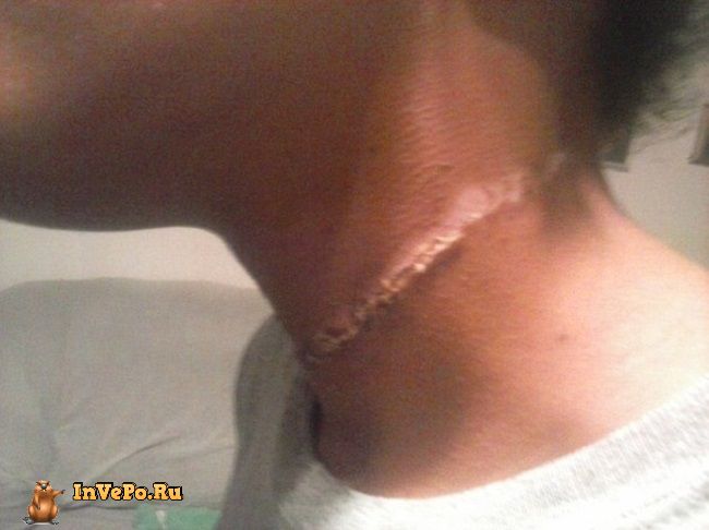 Эту 12-летнюю чернокожую девочку будто тащили за шею на веревке