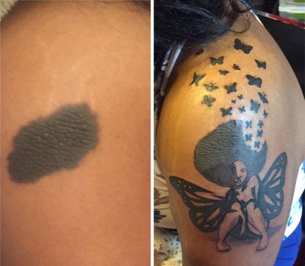 30 способов замаскировать родинки на теле, оригинальными татуировками 